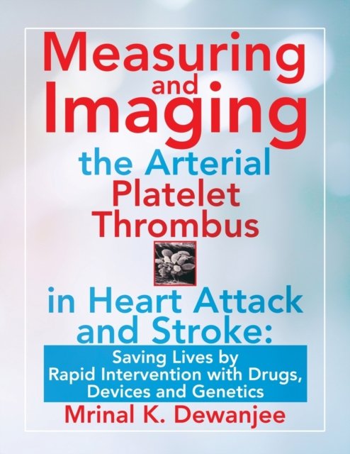 Cover for Mrinal K Dewanjee · Measuring and Imaging the Arterial Platelet Thrombus in Heart Attack and Stroke (Paperback Book) (2021)