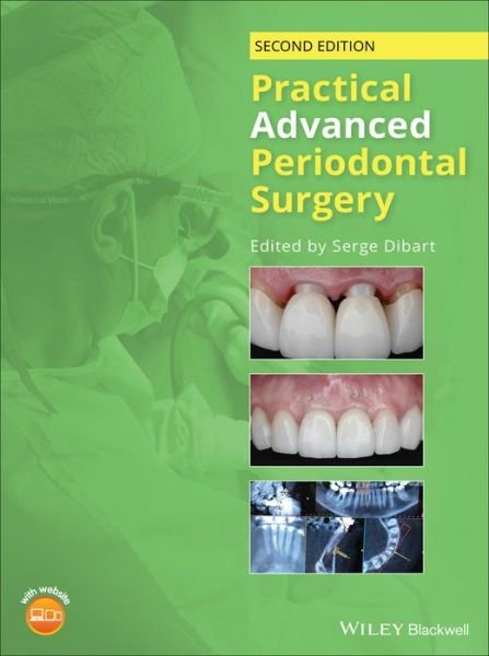 Cover for S Dibart · Practical Advanced Periodontal Surgery (Hardcover Book) (2020)