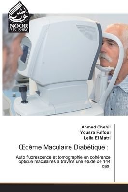 Cover for Chebil · Dème Maculaire Diabétique : (Book) (2020)