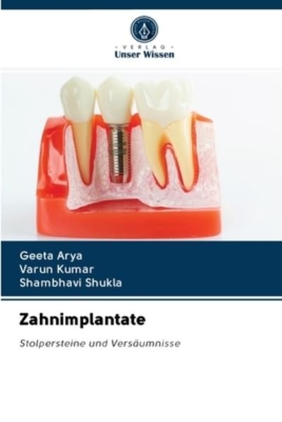 Cover for Arya · Zahnimplantate (Book) (2020)