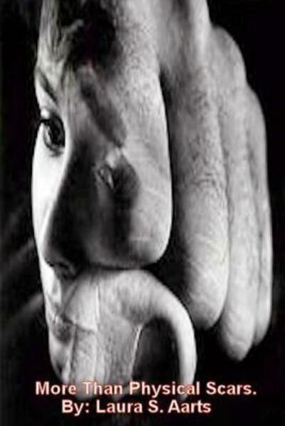 Cover for Laura S. Aarts · More Than Physical Scars. (Paperback Book) (2013)