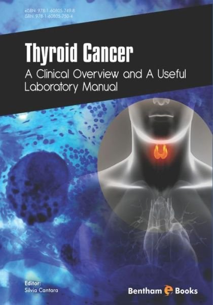 Thyroid Cancer - Silvia Cantara - 图书 - Bentham Science Publishers - 9781608057504 - 2018年1月30日