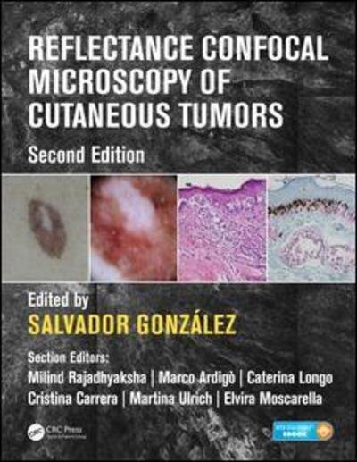 Cover for Salvador Gonzalez · Reflectance Confocal Microscopy of Cutaneous Tumors (Hardcover Book) (2017)