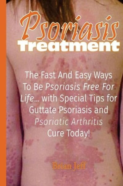 Cover for Brian Jeff · Psoriasis Treatment (Paperback Book) (2016)