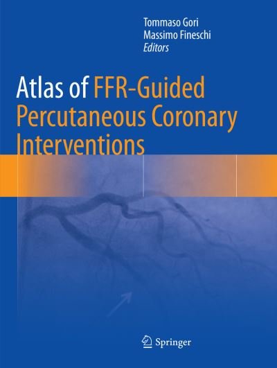 Atlas of FFR-Guided Percutaneous Coronary Interventions -  - 图书 - Springer International Publishing AG - 9783319836607 - 2018年7月17日
