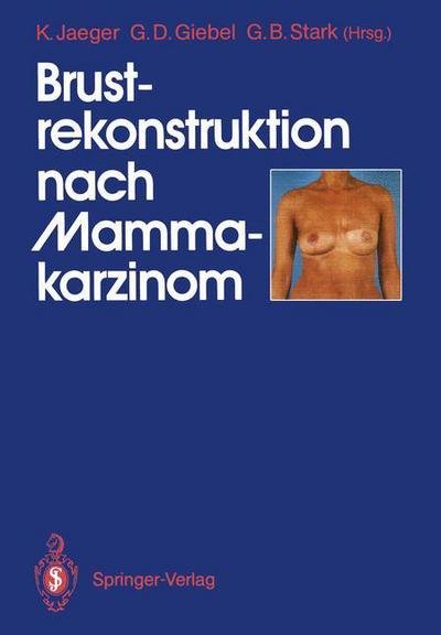 Cover for Klaus Jaeger · Brustrekonstruktion Nach Mammakarzinom (Paperback Book) (1989)