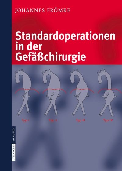 Cover for Johannes Froemke · Standardoperationen in der Gefasschirurgie (Book) [2006 edition] (2006)