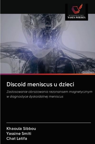 Cover for Khaoula Sibbou · Discoid meniscus u dzieci (Paperback Book) (2020)