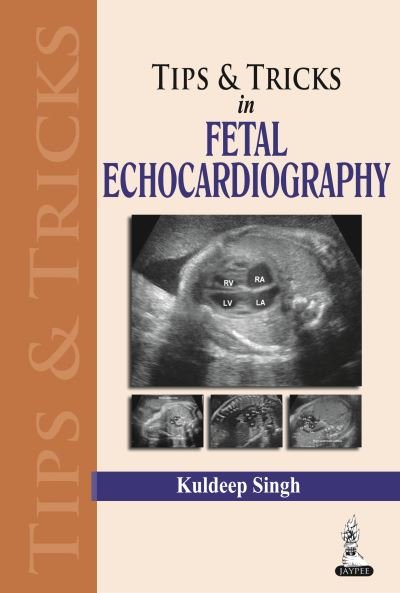 Cover for Kuldeep Singh · Tips &amp; Tricks in Fetal Echocardiography (Paperback Book) (2013)