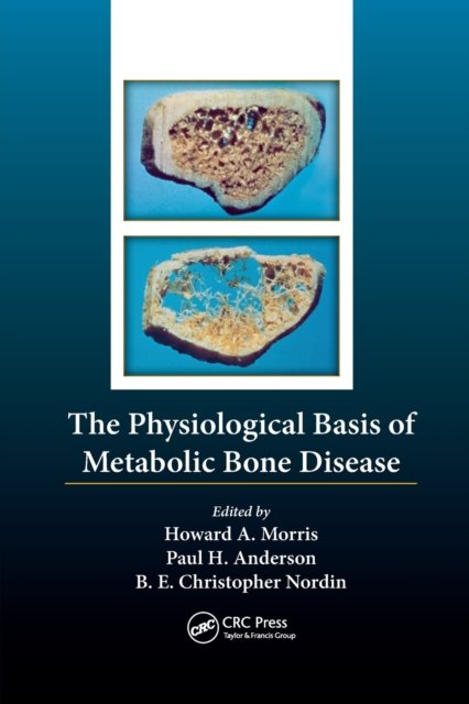 The Physiological Basis of Metabolic Bone Disease -  - 图书 - Taylor & Francis Ltd - 9781138198708 - 2017年10月23日