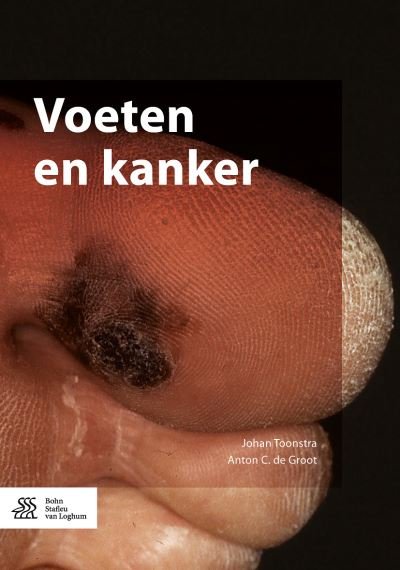Cover for Johan Toonstra · Voeten en Kanker (Paperback Book) (2016)