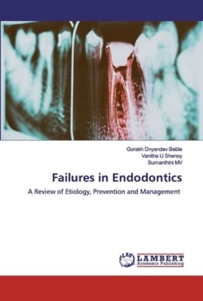 Failures in Endodontics - Beble - 图书 -  - 9786200529862 - 2020年1月9日